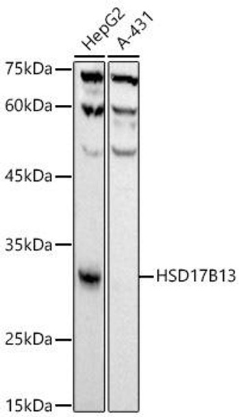 HSD17B13 Monoclonal Antibody (CAB21056)