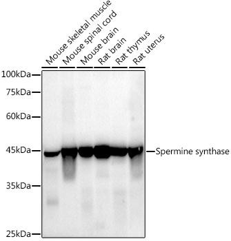 Spermine synthase Monoclonal Antibody (CAB9380)