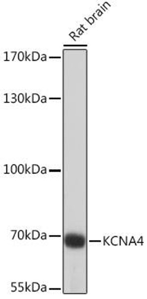 Anti-KCNA4 Antibody (CAB16390)