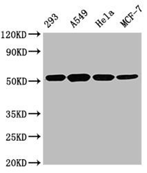 TUBB  Monoclonal Antibody (MACO0666)