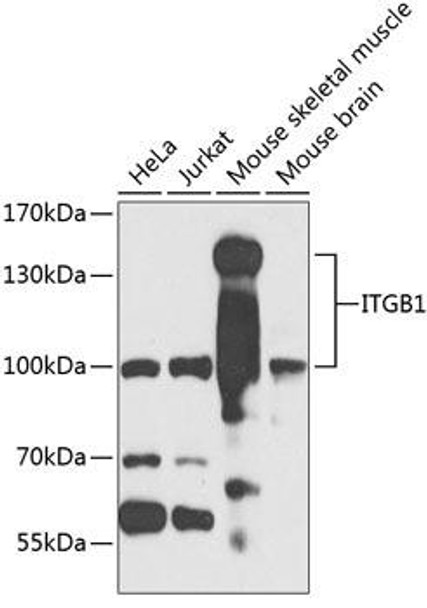 Anti-ITGB1 Antibody (CAB2217)