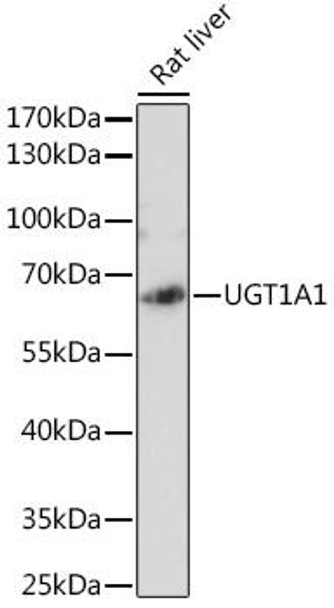 Anti-UGT1A1 Antibody (CAB6186)