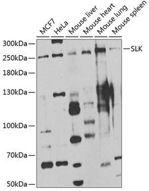 Anti-SLK Antibody (CAB7213)