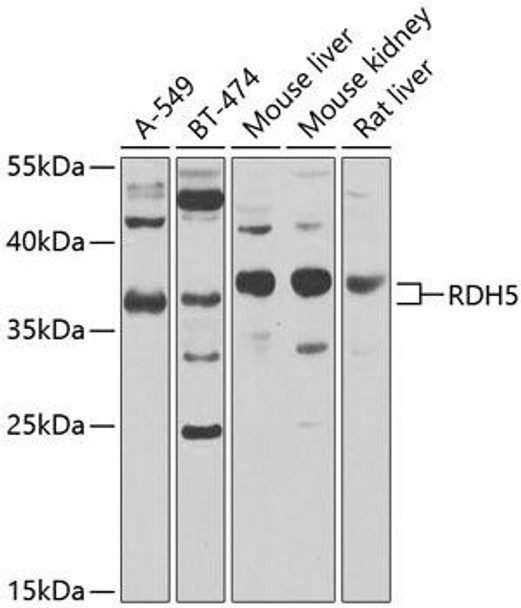 Anti-RDH5 Antibody (CAB8055)