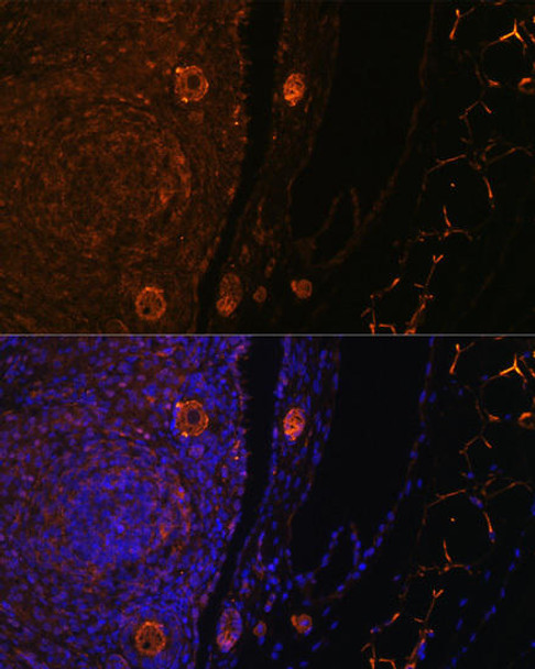 Anti-ZP3 Antibody (CAB8355)