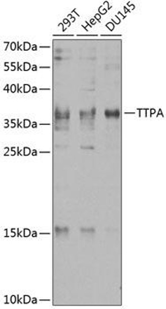Anti-TTPA Antibody (CAB8562)
