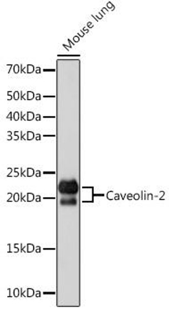 Anti-Caveolin-2 Antibody (CAB4890)