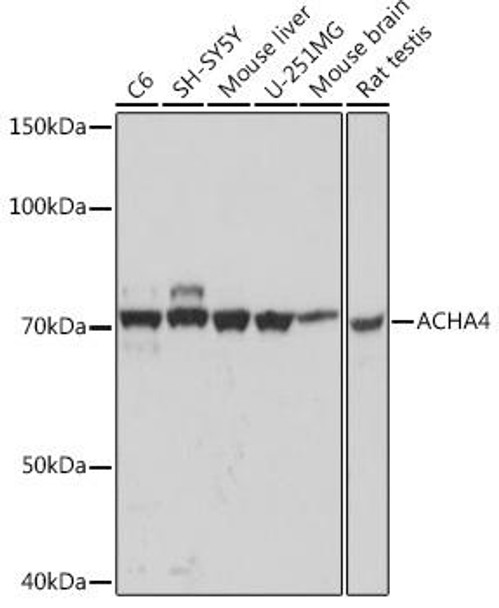 Anti-ACHA4 Antibody (CAB0350)
