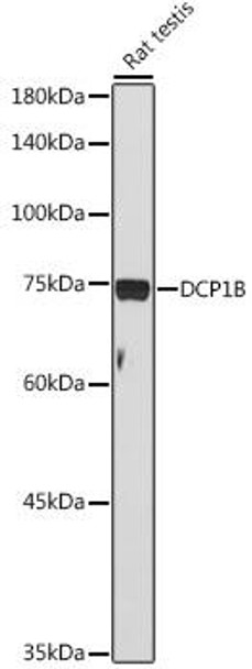 Anti-DCP1B Antibody (CAB20150)