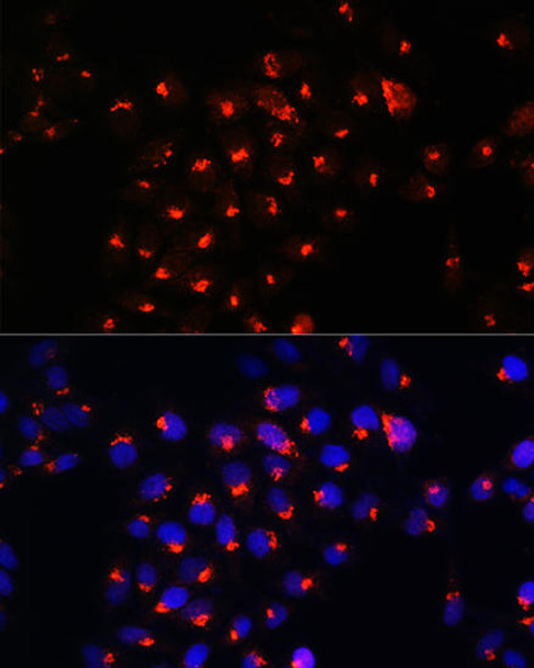 Anti-SGMS1 Antibody (CAB15008)