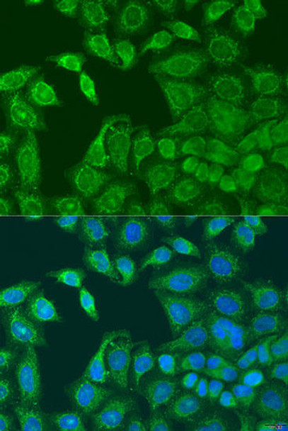Anti-AANAT Antibody (CAB15016)
