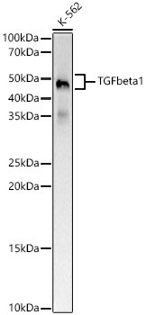 TGF beta 1 Monoclonal Antibody (CAB21244)
