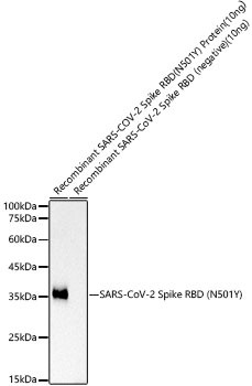 SARS-CoV-2 Spike RBD (N501Y) Monoclonal Antibody (CAB21254)