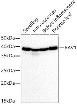 RAV1 Polyclonal Antibody (CAB21275)