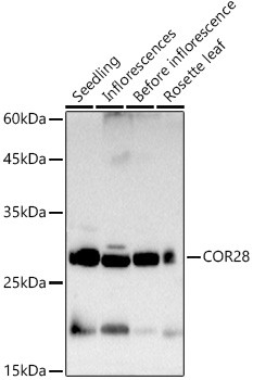 COR28 Polyclonal Antibody (CAB21278)