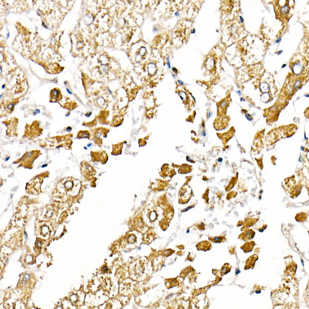 Caspase-1 Polyclonal Antibody (CAB21296)
