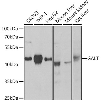 GALT Polyclonal Antibody (CAB21426)