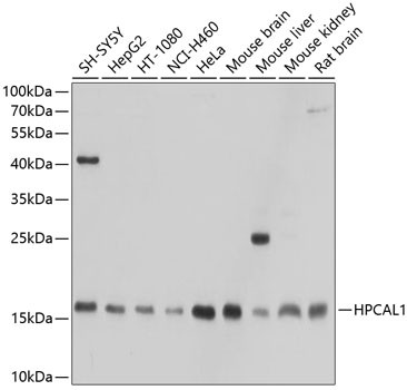 HPCAL1 Polyclonal Antibody (CAB21455)