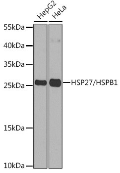 HSP27/HSPB1 Polyclonal Antibody (CAB21461)