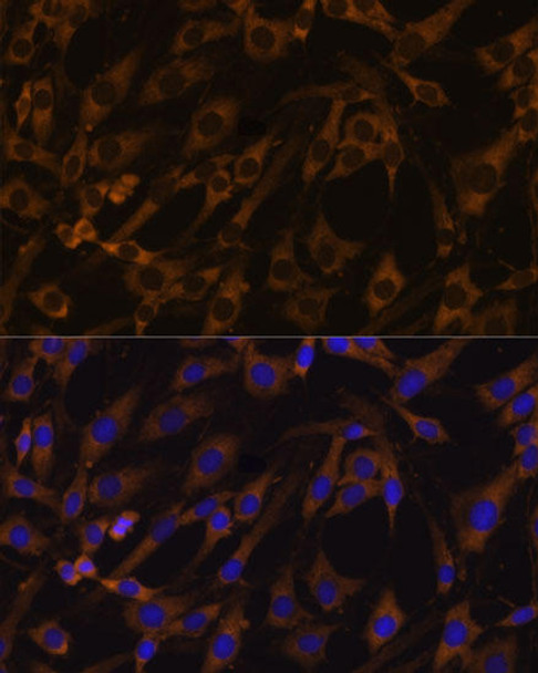 Anti-EIF5B Antibody (CAB15123)