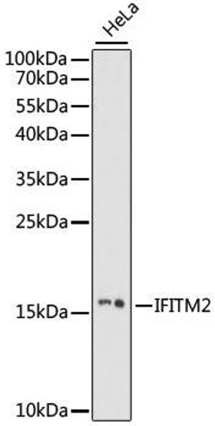 Anti-IFITM2 Antibody (CAB15133)