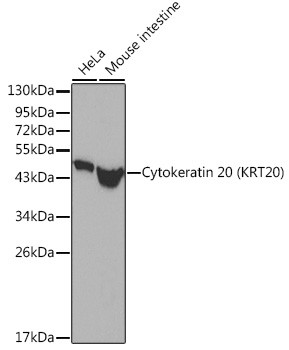 Cytokeratin 20 (KRT20) Polyclonal Antibody (CAB21552)