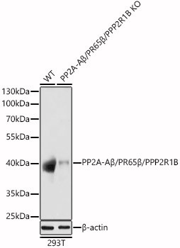 PP2A-Aβ/PR65β/PPP2R1B Polyclonal Antibody (CAB21559)