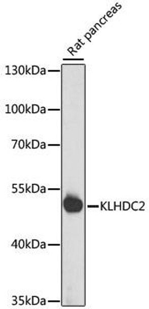 Anti-KLHDC2 Antibody (CAB15147)