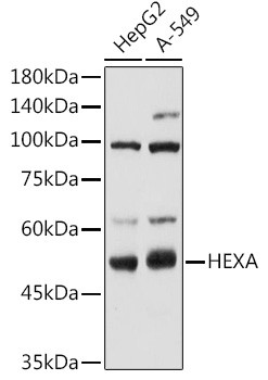HEXA Polyclonal Antibody (CAB21777)