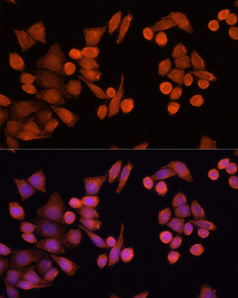 Anti-PLA2G4D Antibody (CAB15224)