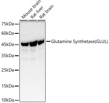 Glutamine Synthetase (GLUL) Polyclonal Antibody (CAB21822)
