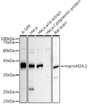 macroH2A.1 Polyclonal Antibody (CAB21836)