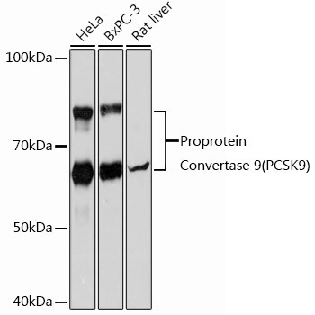 Proprotein Convertase 9(PCSK9) Monoclonal Antibody (CAB21909)