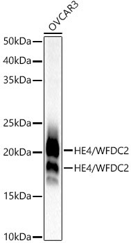 HE4/WFDC2 Monoclonal Antibody (CAB21953)