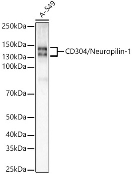 Neuropilin-1 (NRP1) Monoclonal Antibody (CAB22213)