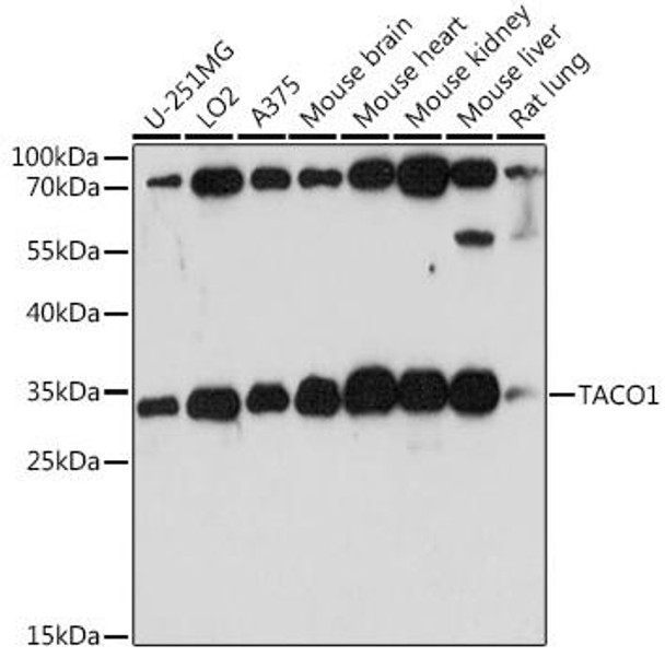 Anti-TACO1 Antibody (CAB15445)