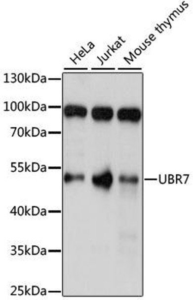 Anti-UBR7 Antibody (CAB15464)