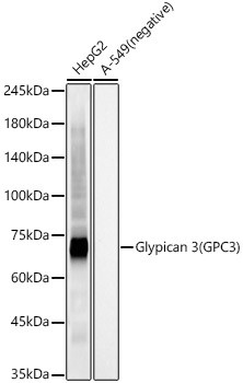 Glypican 3 (GPC3) Monoclonal Antibody (CAB22608)