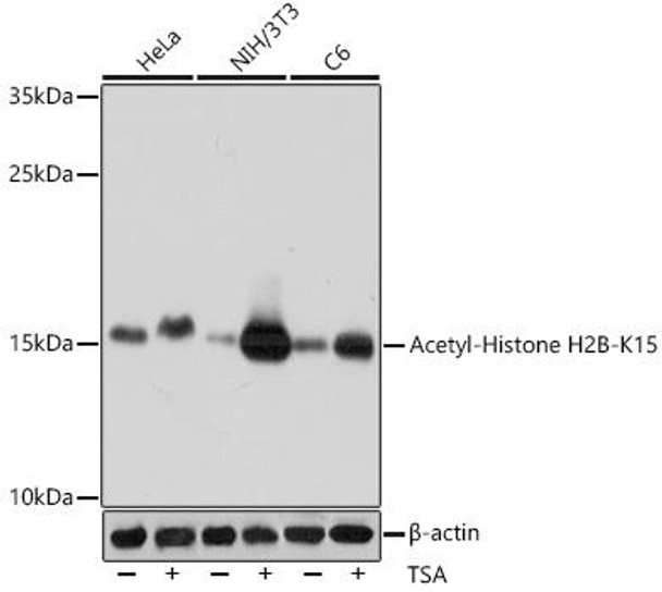 Anti-Acetyl-Histone H2B-K15 Antibody (CAB15622)