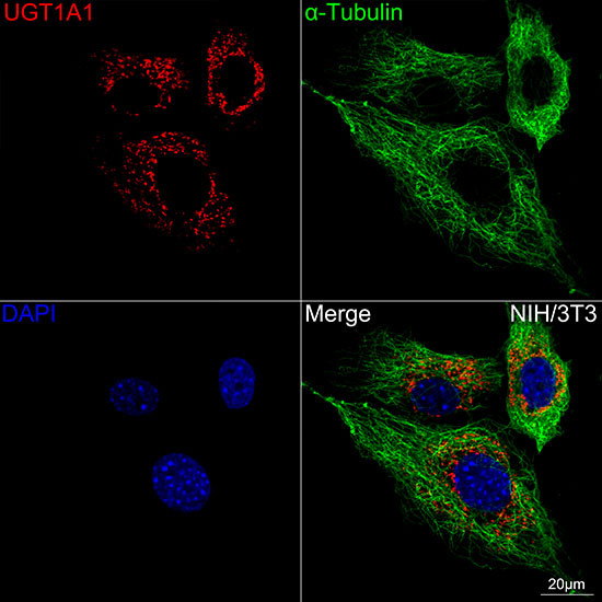UGT1A1 Monoclonal Antibody (CAB22995)