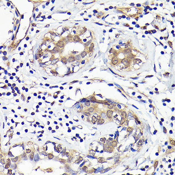 Anti-IMPDH2 Antibody (CAB15626)