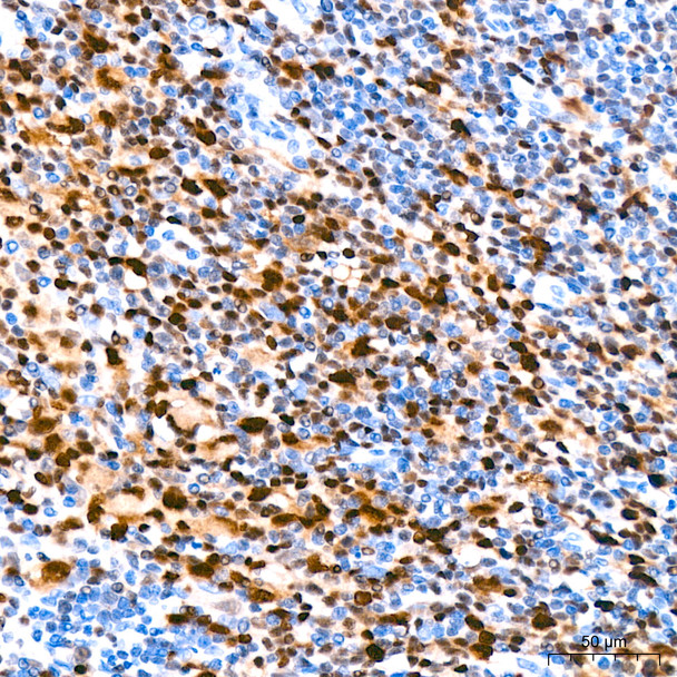 IRF4 Monoclonal Antibody (CAB23227)