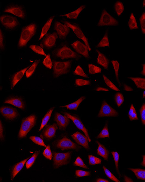 PKC alpha Monoclonal Antibody (CAB23231)