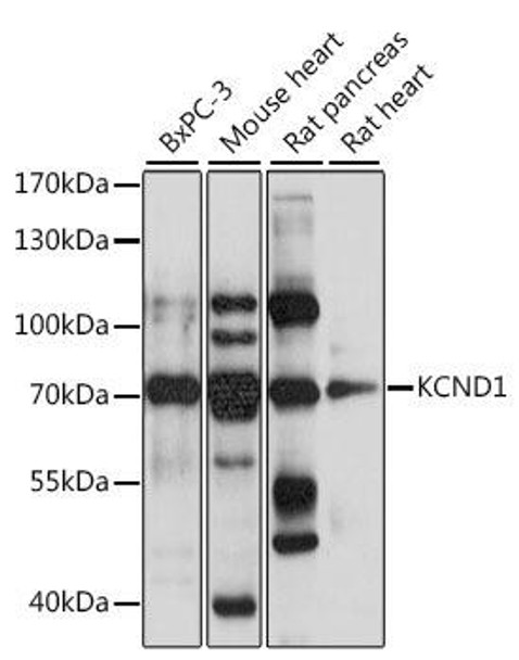 Anti-KCND1 Antibody (CAB15683)