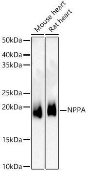NPPA Polyclonal Antibody (CAB23268)
