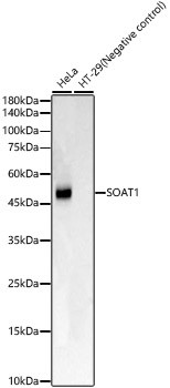 SOAT1 Monoclonal Antibody (CAB23284)