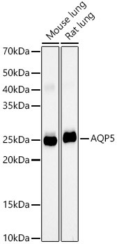 AQP5 Monoclonal Antibody (CAB23292)
