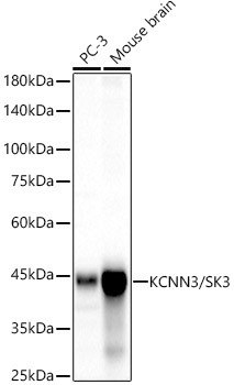 KCNN3/SK3 Monoclonal Antibody (CAB23419)