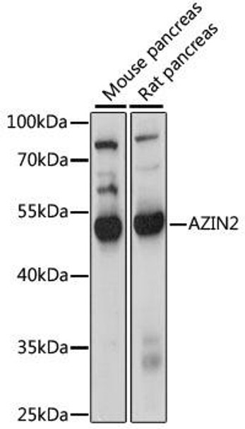 Anti-AZIN2 Antibody (CAB15937)