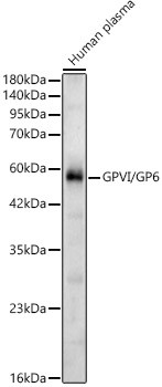 GPVI/GP6 Polyclonal Antibody (CAB24524)